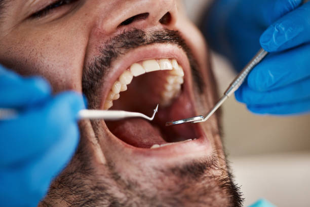 Best Teeth Whitening  in Montgomery, IL